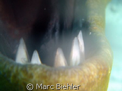 Murray hill teeth by Marc Biehler 